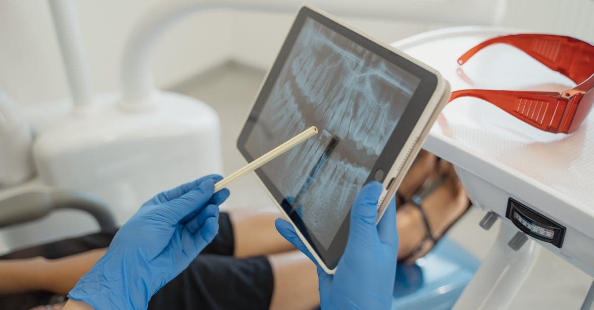 Cover Image for The Truth Behind Root Canal Treatment: Dispelling Common Misconceptions